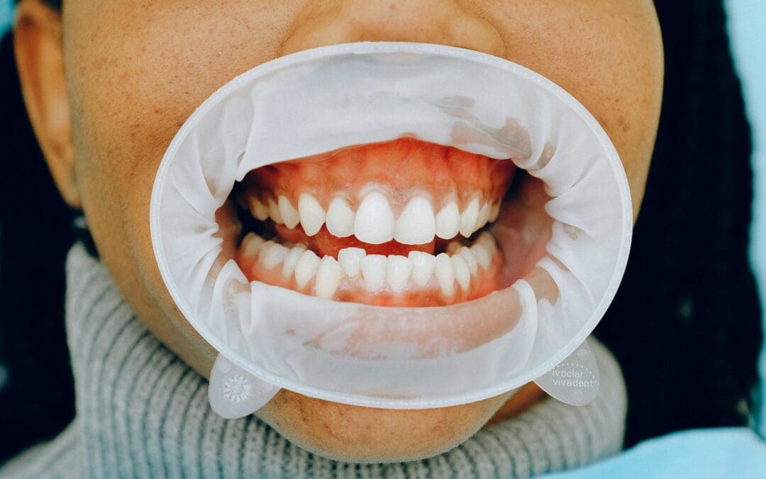 How to Keep Your Teeth Healthy According To Age
