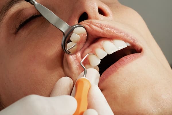 The Top 10 Most Common Dental Problems: Prevention Tips