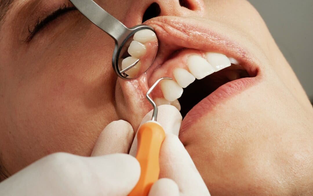 The Causes of Teeth Sensitivity: Tips for Prevention